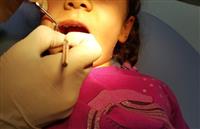 Çocuk Diş (Pedodonti) Tedavisi