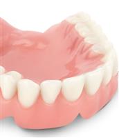Diş Protez (Protetik Tedavi) İşlemleri